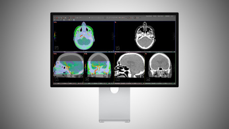 Apple erhält Zulassung für Studio Display XDR im Gesundheitswesen